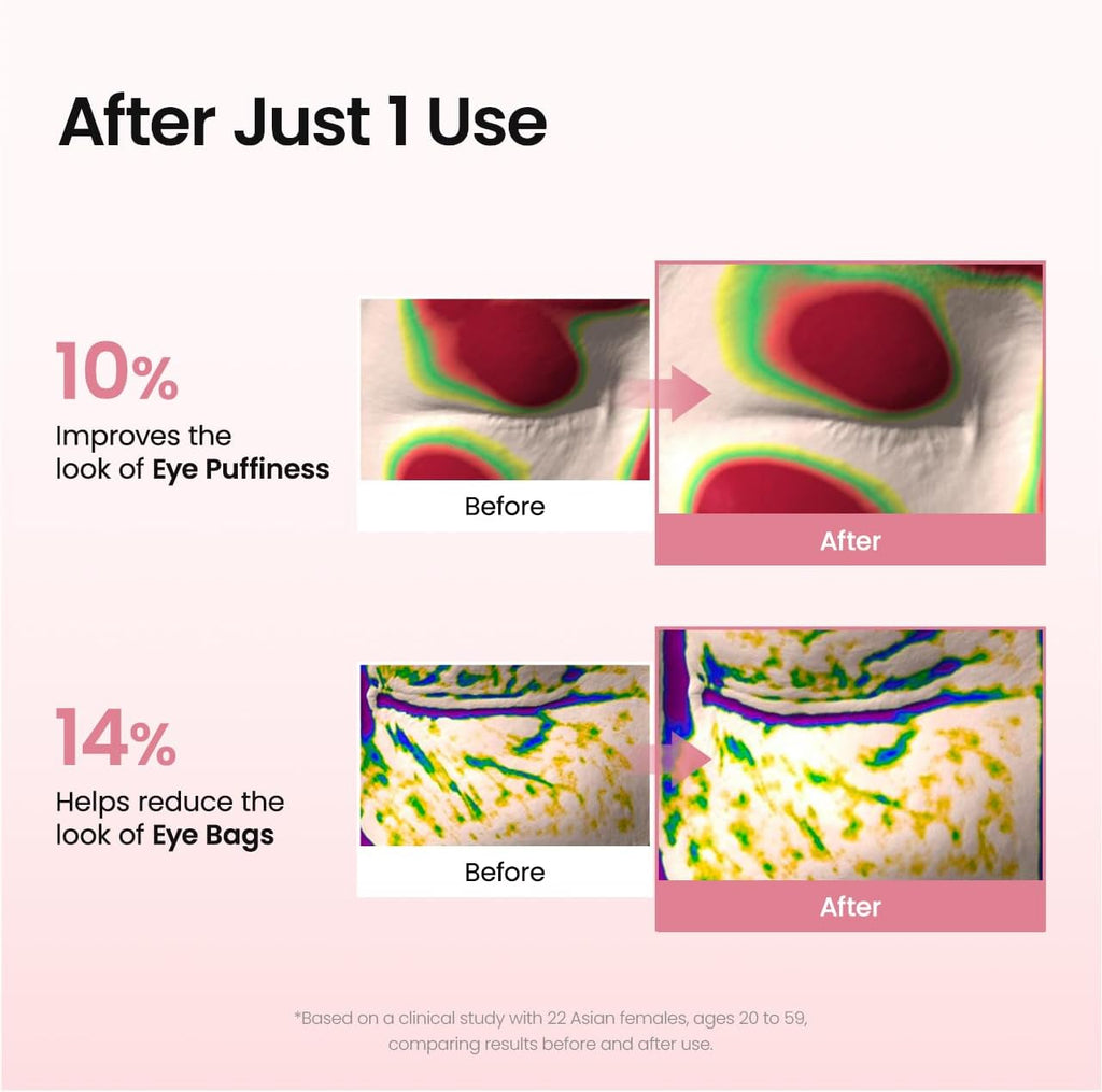 Patchs Yeux Collagen Peptide - Biodance